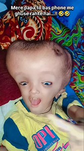 19K views · 802 reactions | Sorry papa ji..!! 藍藍 | Krishna baby hydrocephalus | Facebook