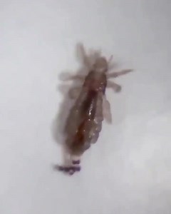 🦠🚫 **Say Goodbye to Lice with the V-Comb Machine!** 🚫🦠 👧🧑 **Safe for Kids & Adults** – No more harsh chemicals! 🌟 **Effective & Easy** – Comb and suction out lice in one step! 🧴💨 **Mess-Free** – Say goodbye to messy treatments! 👩‍👧‍👦 **Family-Friendly** – Protect your loved ones today! 🔍 **How it Works:** 1️⃣ Comb through hair to find lice 2️⃣ Vacuum them up instantly 3️⃣ Dispose of them mess-free 💡 **Why Choose V-Comb?** ✅ Gentle on scalp ✅ Reusable & eco-friendly ✅ Trusted by par