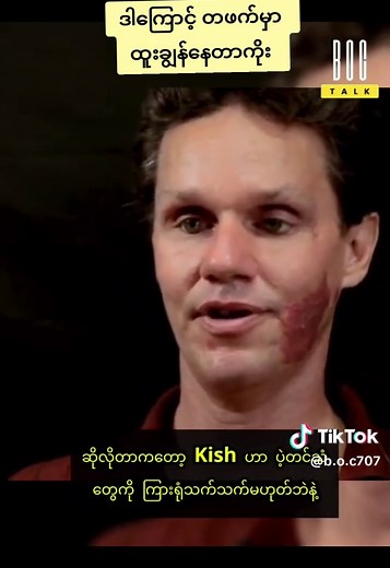 Understanding Human Echolocation Explained by Daniel Kish