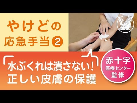 【大正健康ナビ】やけどの応急手当２ 皮膚の保護