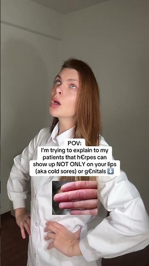 Did you know that h€rpes can also look like THIS? ⬆️🤔 #healthawareness #healthtips #healtheducation