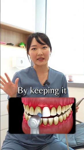 What is a dental cleaning?