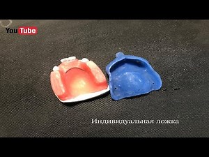 Индивидуальная ложка зубного протеза | Individual tray prosthesis