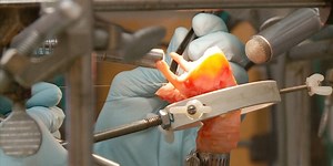 Scientists grew a pair of vocal cords that produce sound — a huge medical advance