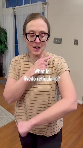 Livedo Reticularis: A Lupus Symptom Explained