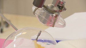 New bariatric surgery technique leads to drastic weight loss for North Texas man