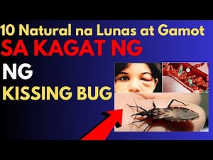 10 Natural na Lunas at Gamot sa kagat ng kissing bug, Home remedies, Natural na paraan at first aid
