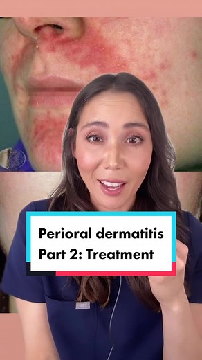 Effective Treatment for Perioral Dermatitis with Dermatologist Recommended Skincare Tips
