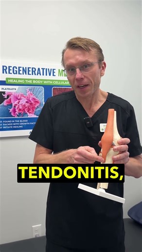 Say Goodbye to Patellar Tendonitis Pain Today
