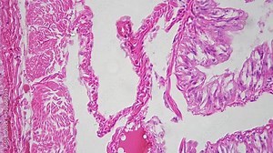 Earthworm filmed under microscope 400x in transversal section against bright field background. Static macro of cross cut invertebrate organism prepared for the research at university on biology lesson