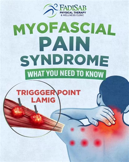 Myofascial Pain Syndrome: Paano Ito Haharapin