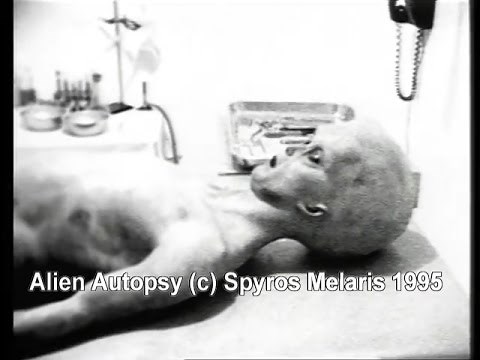 The Alien Autopsy