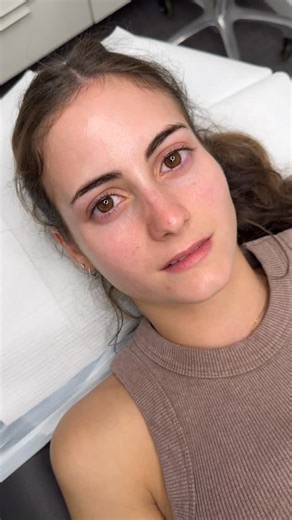 3 comments | Powder Brows ✨ It’s not always about a totally make over when it comes to some brows, sometimes it’s about minor tweaks to add detail in all the right places. My goal is always to gently enhance not over power. This beauty now has neat defined, symmetrical & effortless brows which will compliment her for years to come. 2026 is booking up fast, book your appointment online today X | Yolanda Deluca Cosmetic Tattoo | Facebook