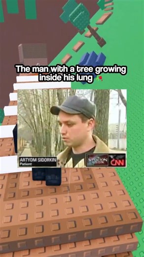 The Real Life TREE MAN?! 💀😱 | True Story | Roblox