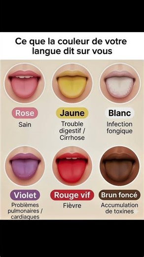 DE QUELLE COULEUR EST VOTRE LANGUE?