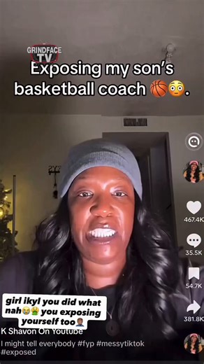 Why does she look like Rasputia after weight loss?