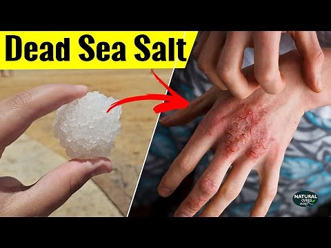 Dead Sea Salt Benefits | Where to Buy Dead Sea Salt