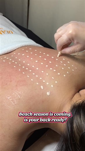 Get beach-ready back skin! Book your BB Glow session and glow with confidence! Visit us at Glam & Glow Beauty Expert! #bbglowph #glamandglowph