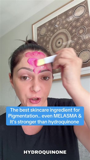 Best Ingredient for Melasma and Hyperpigmentation
