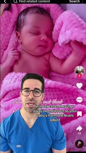What To Do If Your Baby Has Breast Buds 👶 | Dr. Yoshi Explains What’s Normal