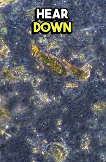 Shrimp vein explained under the microscope: what it really is