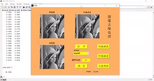 MATLAB图像去噪[完美运行，GUI界面，详细教程，万字文稿]