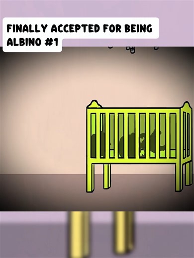 Finally Accepted For Being Albino | albinism
