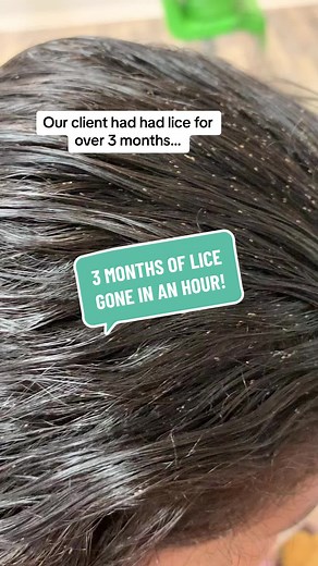 We can have you lice free in an hour, or teach you everything you need to do to successfully treat lice at home. #liceremoval #licetreatment #licetok #licecenterswi #fyp