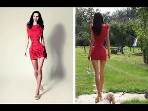Valeria Levitin, a mulher mais magra do mundo.