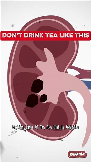 Don’t Drink Tea This Way If You Have Kidney Problems