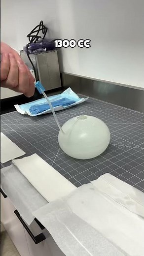 Overfilling a 420cc Implant to 2000ccs… | Dr. Matthew J. Nykiel