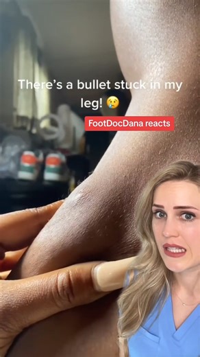 Dr. Dana Figura, DPM on Instagram: "See a doctor! #bullet #injuries #doctorreacts #medical"