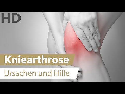 Arthrose im Kniegelenk: Wie sie entsteht & was du tun kannst