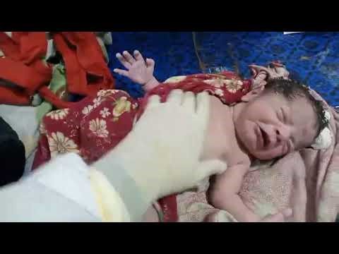 Newborn Baby Suctioning in NICU | Airway Clearance & Immediate Care |