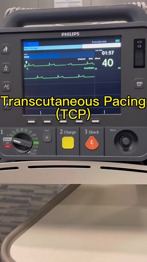Transcutaneous Pacing (TCP) Explained for Emergency Care