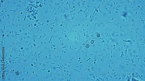 Human dental plaque under a microscope. Thousands of different bacteria are visible in the frame. Staphylococcus, Streptococcus, Candida and yeast bacterias in the frame