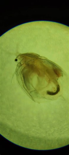 Close-up view of a water flea. #microscope #microbiology #fyi #fyp #waterflea