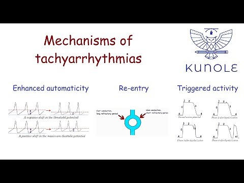 Tachycardias (4.1). Mechanisms of tachyarrhythmias