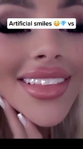 Miswak is a natural teeth-cleaning stick made from the Salvadora persica tree, used for centuries across Africa. Many Africans still use miswak daily without toothpaste, and studies show it helps prevent cavities, whiten teeth, and support gum health often outperforming modern toothbrushes. #cavities #toothbrush #teethwhitening | Healthy living