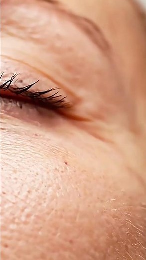 AI Blackhead Removal — Deep Cleaning Simulation #shorts