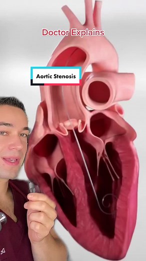 Understanding Aortic Stenosis: Causes and Treatment Explained
