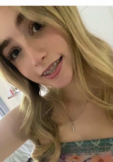 BRACESSS #rubylishous #fyp #trend #relatable #spam #spamaccount #viral #silly #braces #teeth