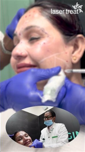 Botox and Filler Treatment | Smooth Wrinkles & Restore Facial Volume