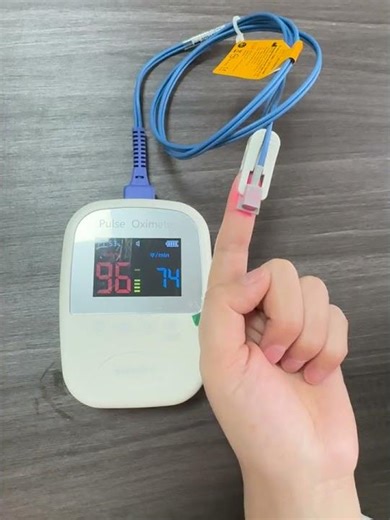 Looking for a lightweight veterinary pulse oximeter? #pulseoximeter
