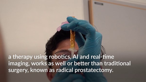 Trial for prostate cancer treatment with fewer side-effects launches in UK