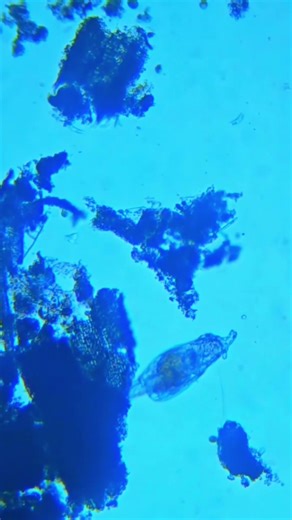 Testing water filter results with a microscope🔬 #waterfilter #survival #survivaltips #waterdropfilter #waterdroplifestraw #microscope #microbiology #microorganisms | Survival Life