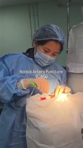 RADIAL ARTERY PUNCTURE #cathlab #cardiology