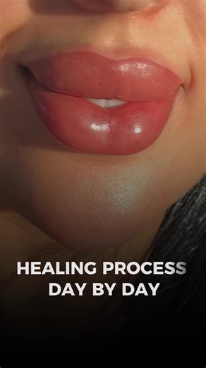 ‏Healing process of lip coloring day by day #lipcolor
