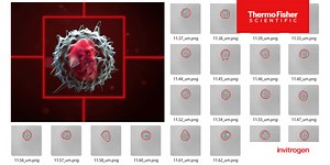 Automated image analysis reduces user-to-user variability in flow cytometry gating strategies