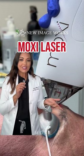 Laser Treatment for Hyperpigmentation & Dark Spots | Carolina Explains